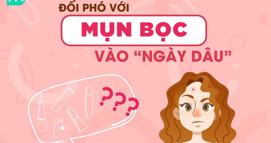 cach-doi-pho-voi-mun-boc-ngay-dau