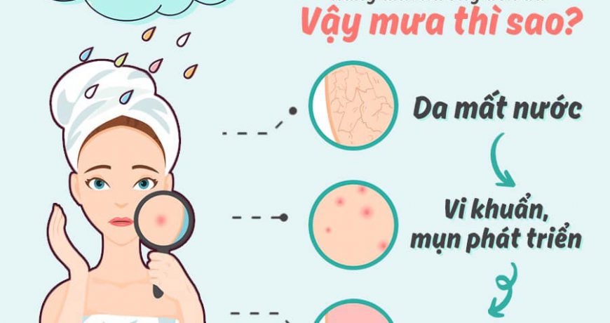 Cảnh Báo Cấp Độ Đỏ - Mưa Ảnh Hưởng Đến Da Như Thế Nào? canh-bao-cap-do-do-mua-anh-huong-den-da-nhu-the-nao