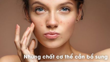 nhung-chat-co-the-can-bo-sung-khi-bi-mun