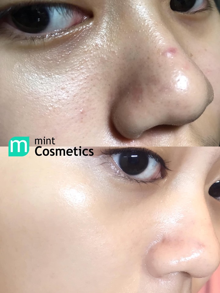 review-mat-na-sexy-look-tram-tra4