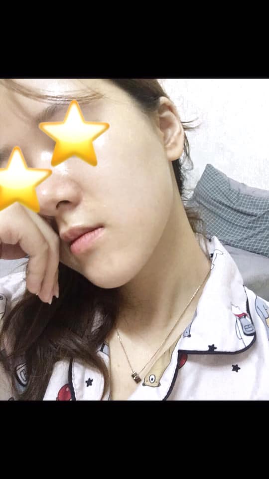 review-serum-lam-sang-tri-tham-acnes-c10