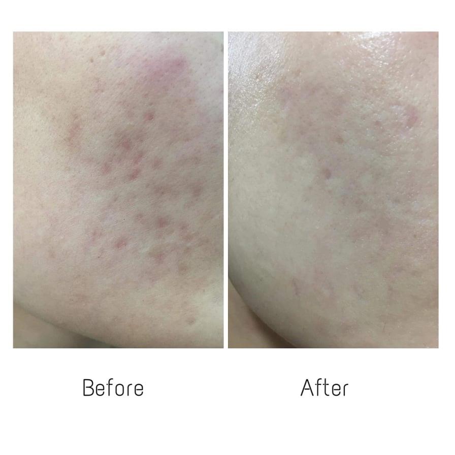 review-serum-paula-choice-niacinamide