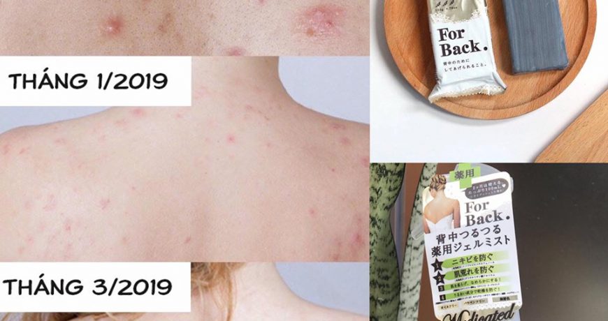 bo-doi-tri-mun-lung-so-1-nhat-ban-for-back