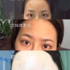 kem-duong-obagi-nu-derm-clear-fx-tri-tham-lam-trang