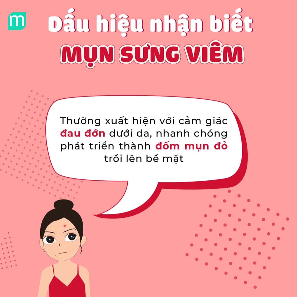 kien-thuc-tri-mun-sung-viem-cac-san-pham-dac-tri