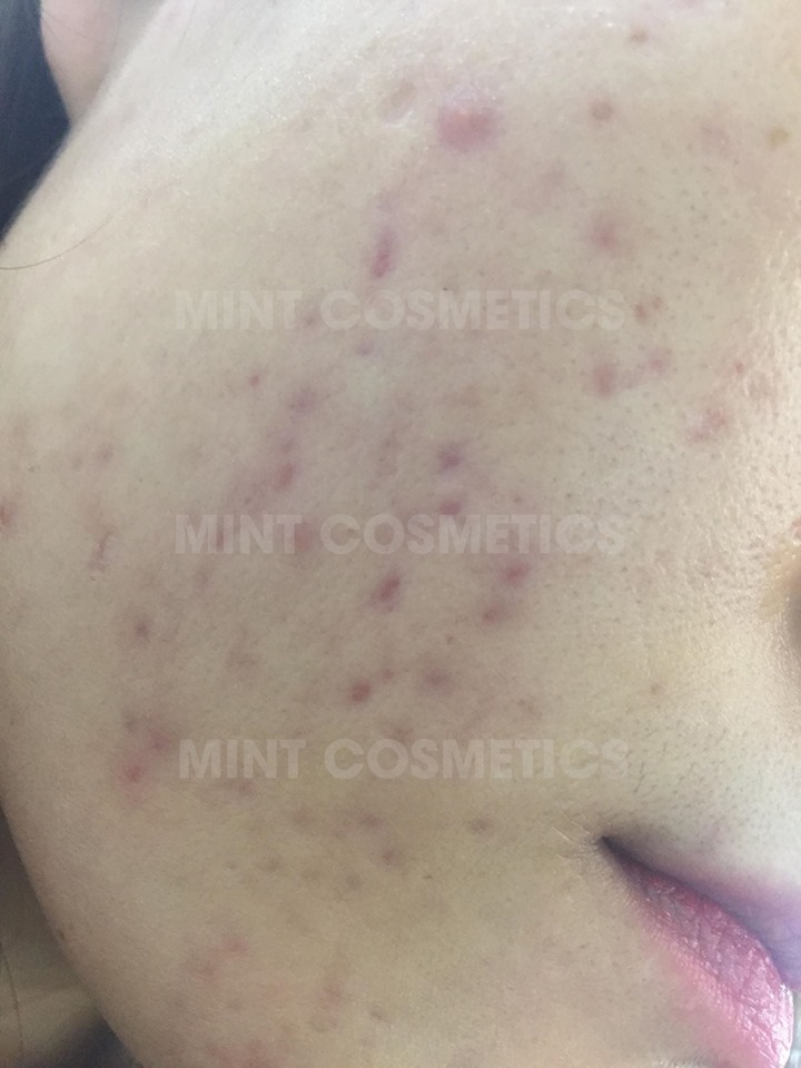 review-serum-paulas-choice-niacinamide
