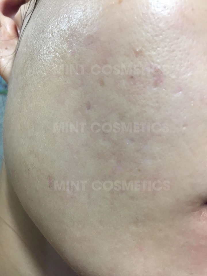 review-serum-paulas-choice-niacinamide