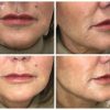 serum-obagi-professional-c-peptide-complex1