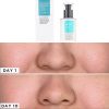 tinh-chat-cosrx-two-in-one-poreless-power-liquid tinh-chat-cosrx-two-in-one-poreless-power-liquid