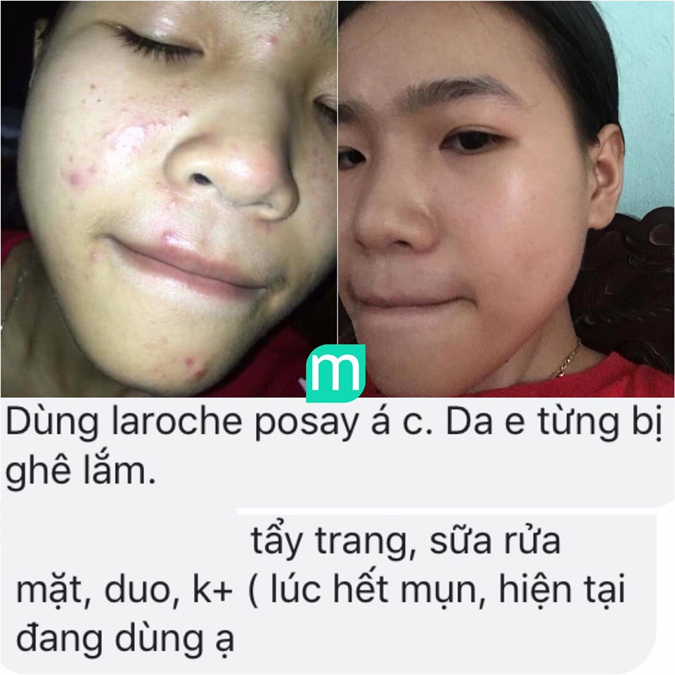 tong-hop-review-laroche-posay-dong-effaclar