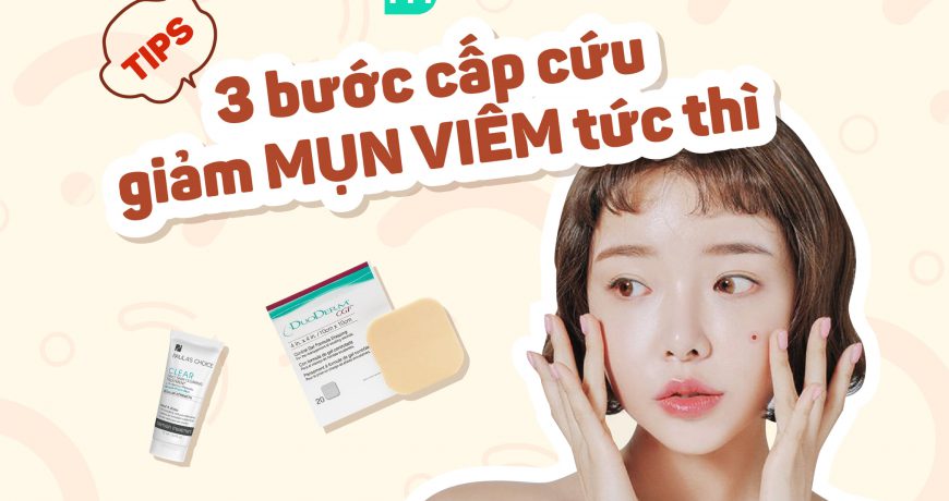 3 Bước Cấp Cứu Giảm Mụn Viêm Tức Thì
