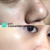 hop-mat-na-sexylook-tea-tree-anti-blemish-5-mieng-dong-thai-doc