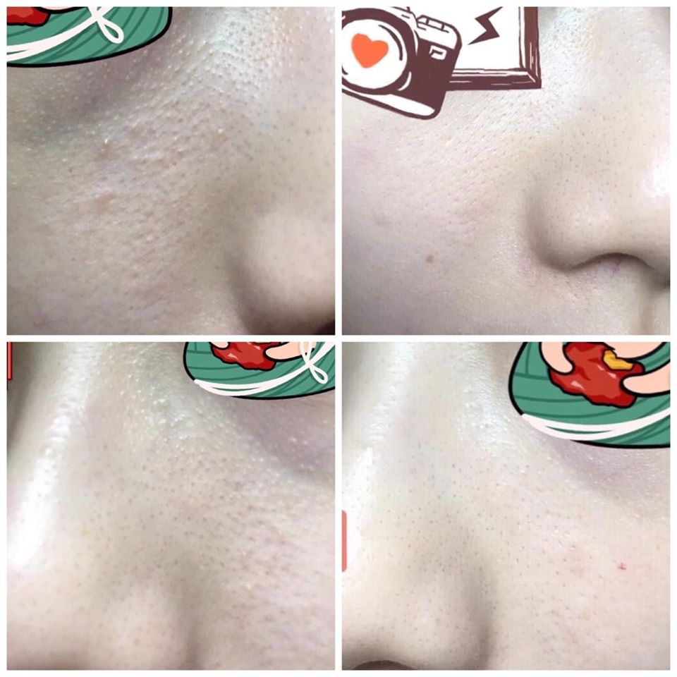 Review Serum Neostrata Bionic 10 review-serum-neostrata-bionic-10