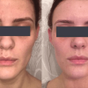 kem-duong-obagi-nu-derm-blender-rx-52