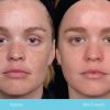 kem-duong-obagi-nu-derm-blender-rx-55