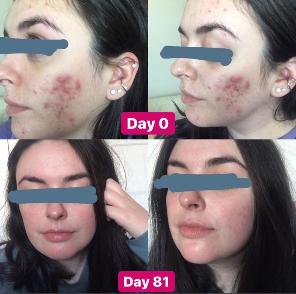 nhung-feedback-dang-kinh-ngac-sau-khi-su-dung-retinol7