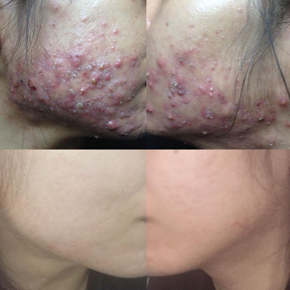 nhung-feedback-dang-kinh-ngac-sau-khi-su-dung-retinol7