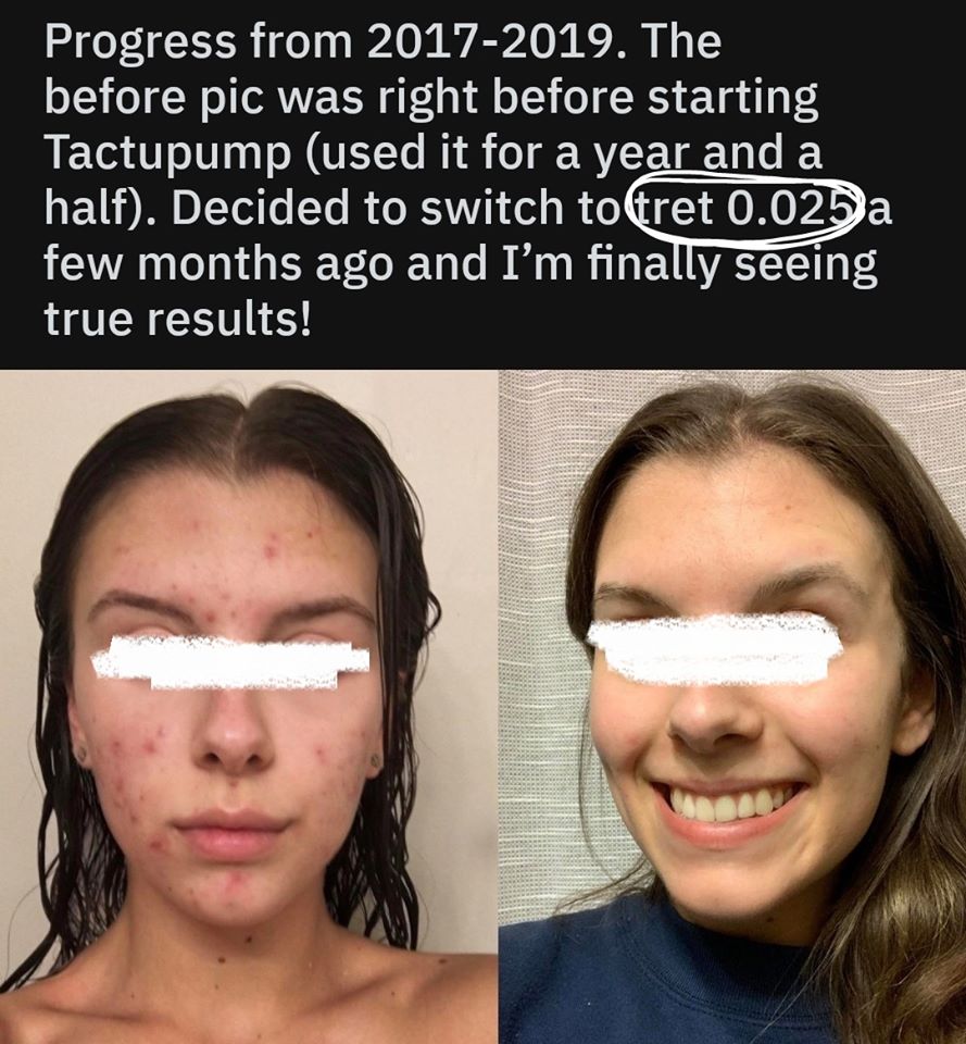 nhung-feedback-dang-kinh-ngac-sau-khi-su-dung-retinol7