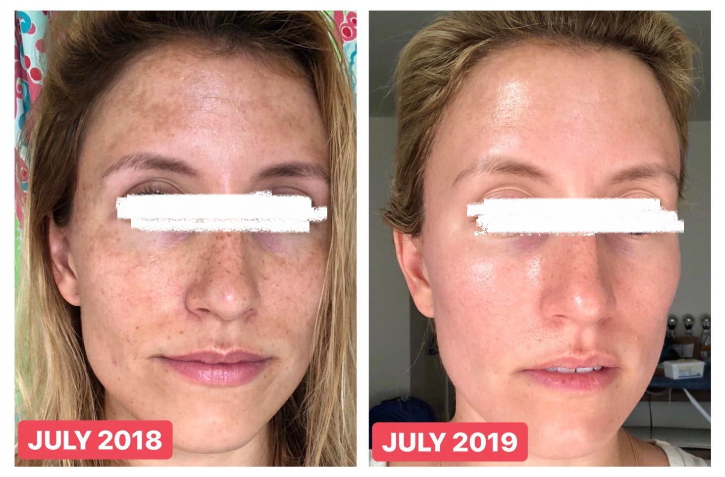 nhung-feedback-dang-kinh-ngac-sau-khi-su-dung-retinol7