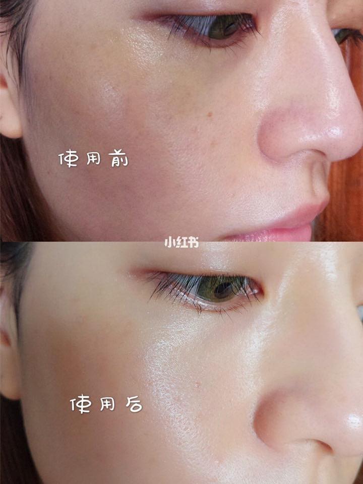 review-kem-chong-nang-ultrasun-face-ant-age-anti-pigmentation-spf-50