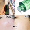 nuoc-hoa-hong-naruko-shine-control-blemish-clear-toner-150ml