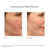 set-murad-tri-mun-blemish-control-power-couple3