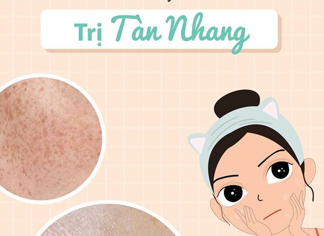 Bạn Cần Trị Nám Hay Cần Trị Tàn Nhang? ban-can-tri-nam-hay-can-tri-tan-nhang
