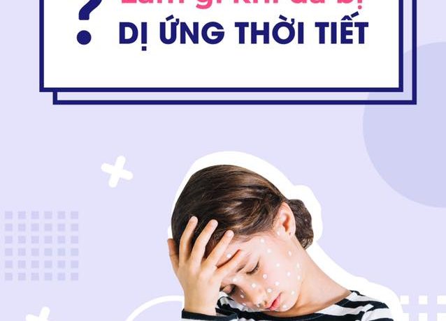lam-gi-khi-da-bi-di-ung-thoi-tiet