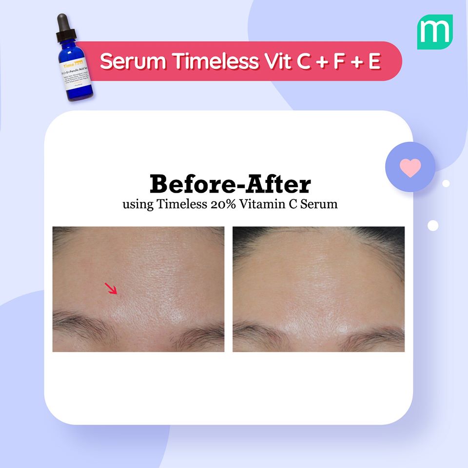 Review 5 Sản Phẩm Trị Thâm Mụn Hiệu Quả review-5-san-pham-tri-tham-mun-hieu-qua2