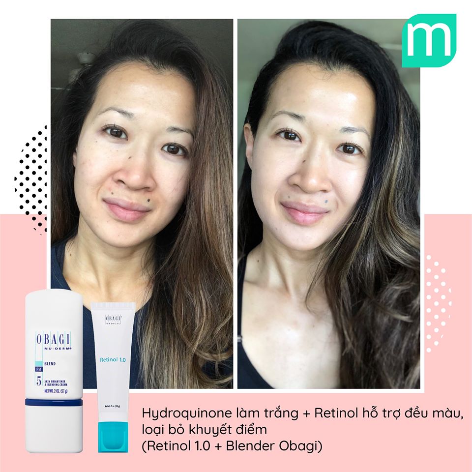 Bộ Đôi Trị Mụn Nám Bất Bại Từ Obagi bo-doi-tri-mun-nam-bat-bai-tu-obagi