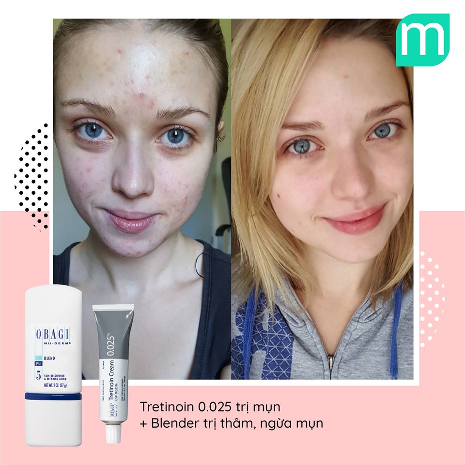 Bộ Đôi Trị Mụn Nám Bất Bại Từ Obagi bo-doi-tri-mun-nam-bat-bai-tu-obagi