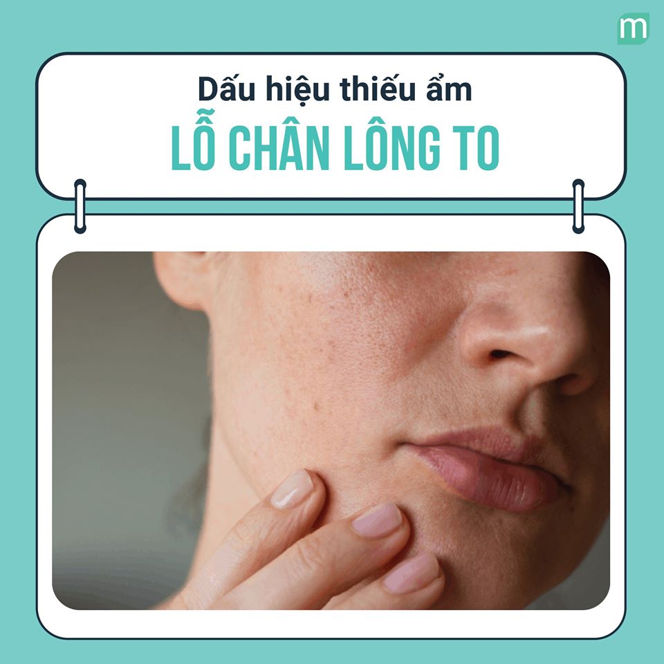 nhung-dau-hieu-da-ban-dang-thieu-am-chu-khong-phai-len-mun