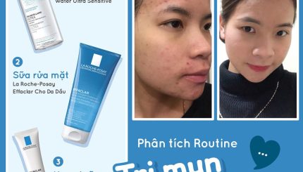 phan-tich-routine-tri-mun-thanh-cong-sau-3-thang