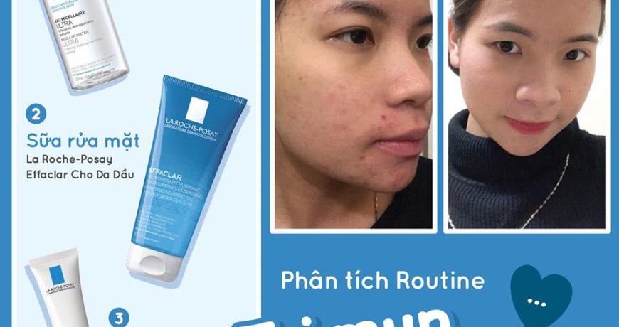 phan-tich-routine-tri-mun-thanh-cong-sau-3-thang