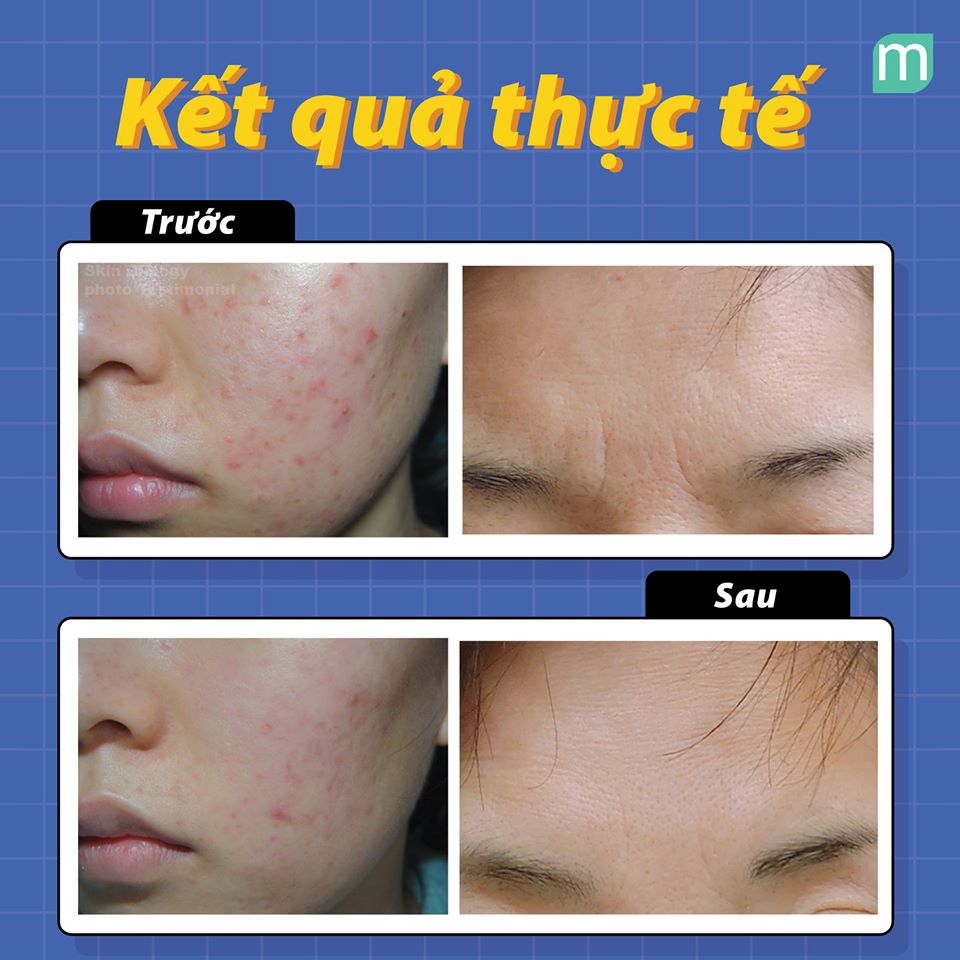 vi-sao-peptides-xung-dang-co-mat-trong-routine