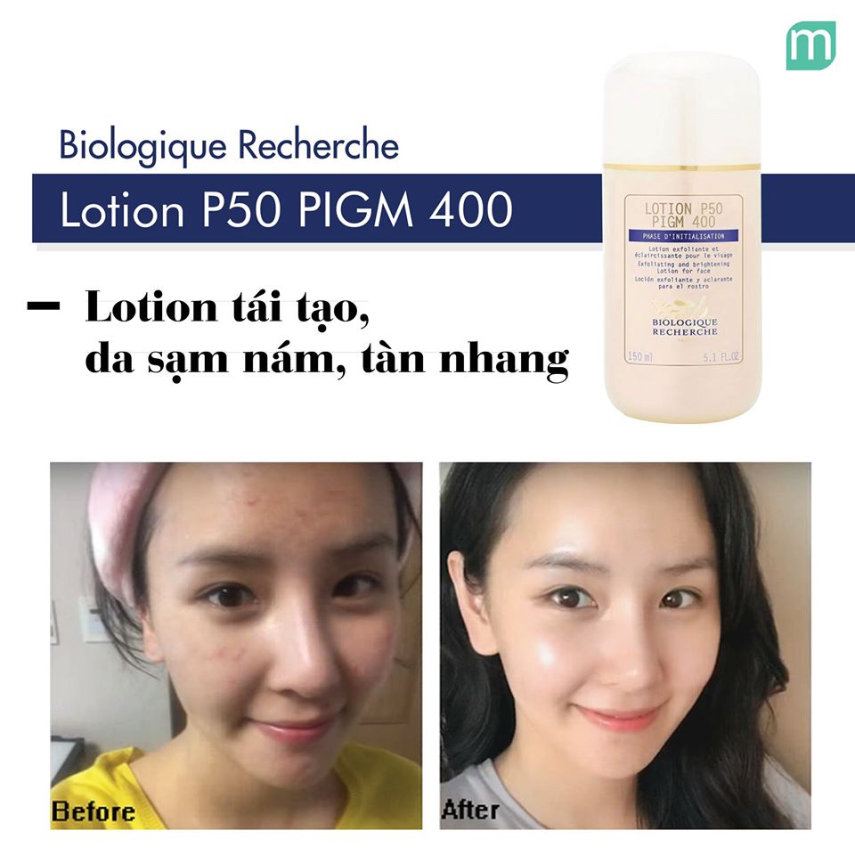 Yêu Làm Đẹp - Nghiện Lotion Biologique Recherche yeu-lam-dep-nghien-lotion-biologique-recherche