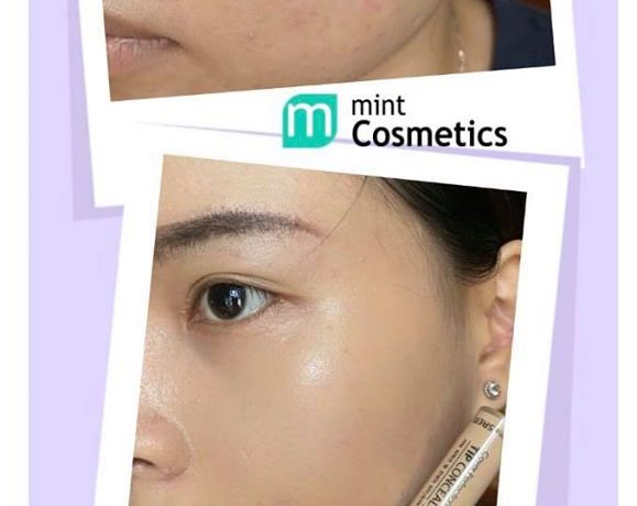cac-tips-che-khuyet-diem-cho-da-mun