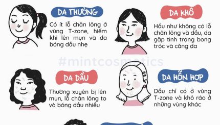 da-ban-thuoc-loai-da-nao