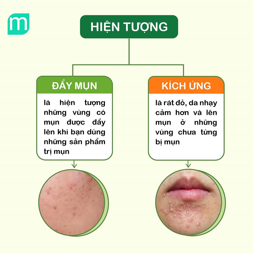 nhan-biet-day-mun-va-kich-ung