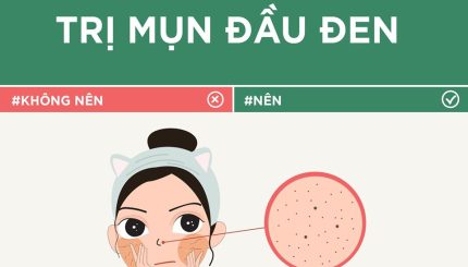nam-tron-cac-tips-don-gian-giup-tri-mun-dau-den