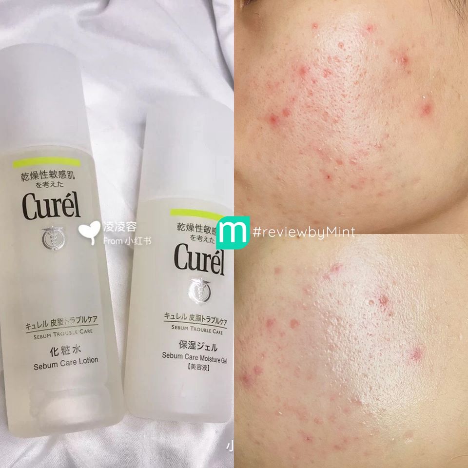 review-bo-doi-lanh-tinh-lam-diu-da-dau-mun-tu-curel