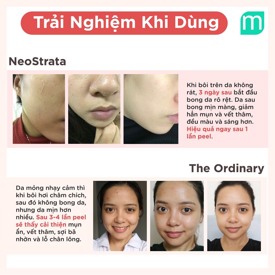 so-sanh-2-loai-peel-da-neostrata-prosystem-peel-va-the-ordinary