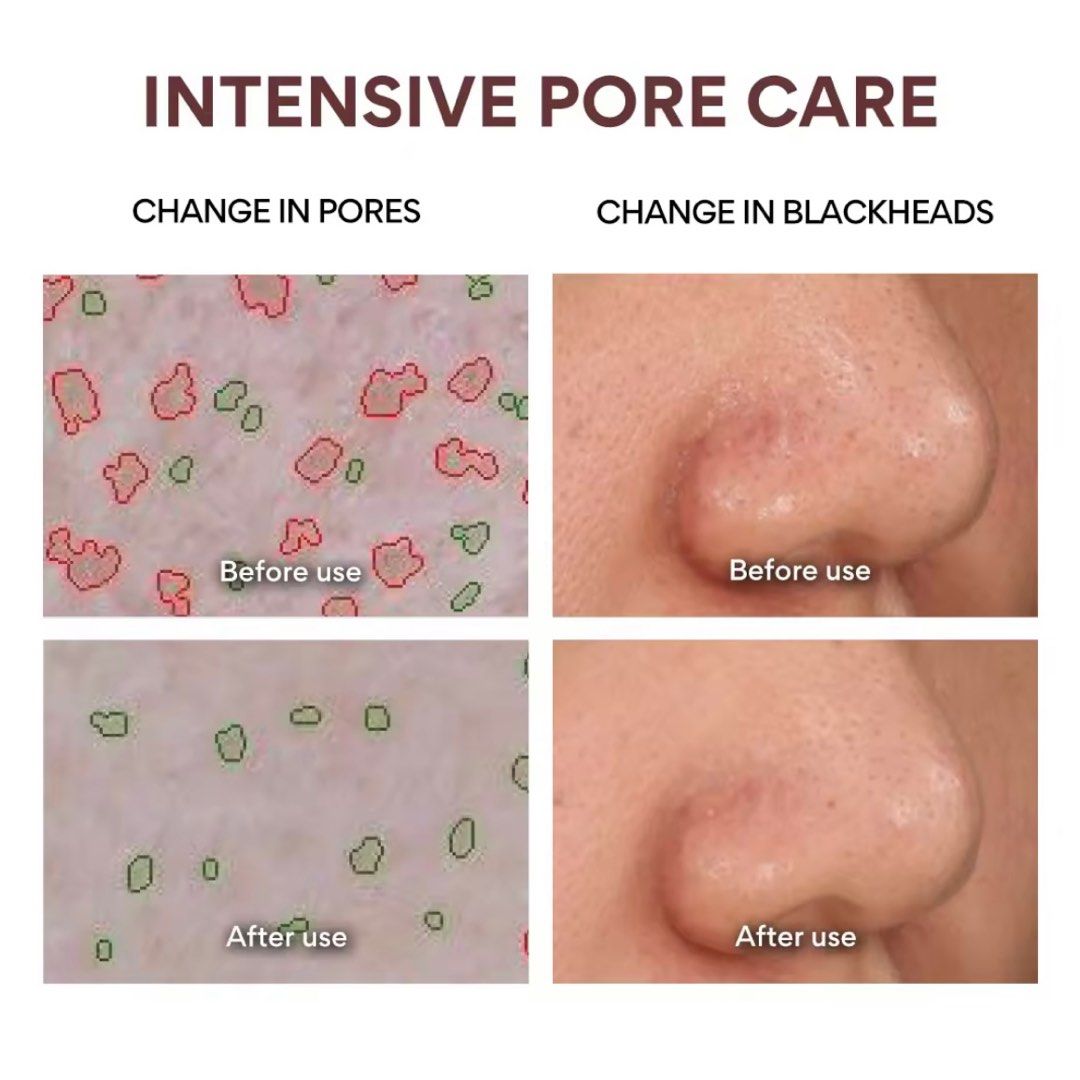 Mặt Nạ Innisfree Super Volcanic Pore Clay Mask 100ml