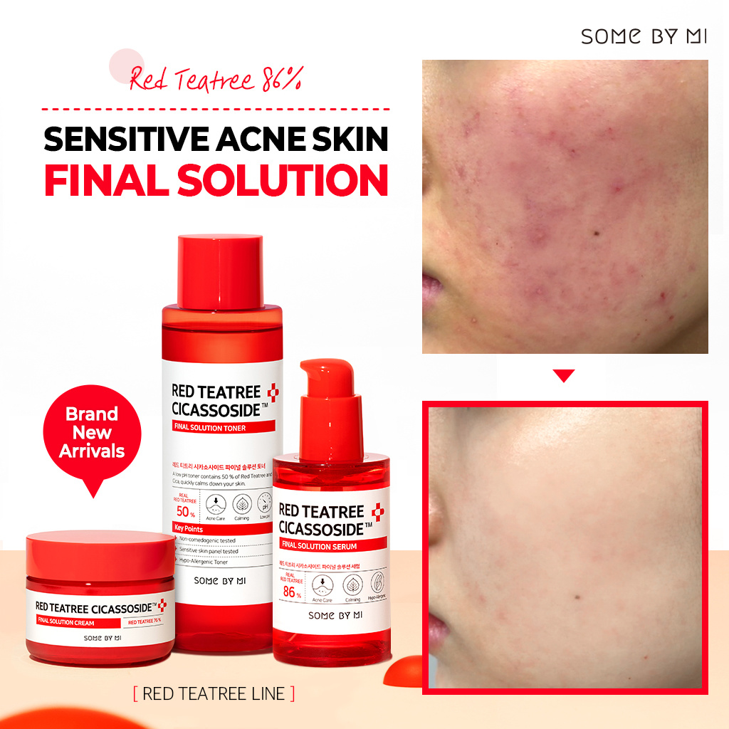 Serum Some By Mi Red Teatree Cicassoside Serum Some By Mi Red Teatree Cicassoside