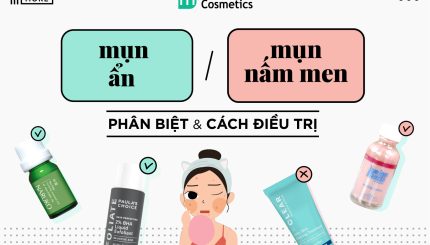 ban-co-dang-nham-lan-giua-mun-an-va-mun-nam-men