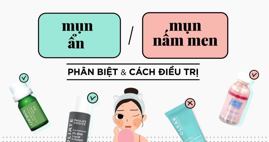 Bạn Có Đang Nhầm Lẫn Giữa Mụn Ân Và Mụn Nấm Men? ban-co-dang-nham-lan-giua-mun-an-va-mun-nam-men