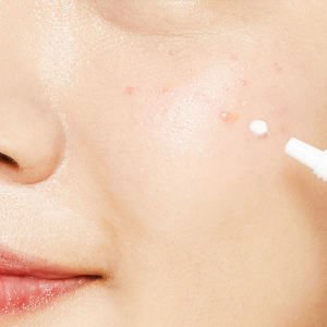 Chấm Mụn Dạng Kem Cosrx Ultimate Spot Cream 30g