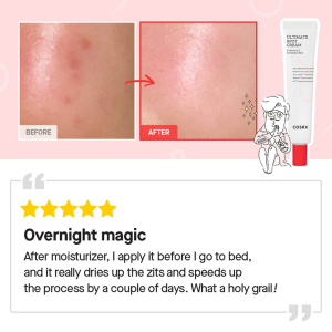 Chấm Mụn Dạng Kem Cosrx Ultimate Spot Cream 30g
