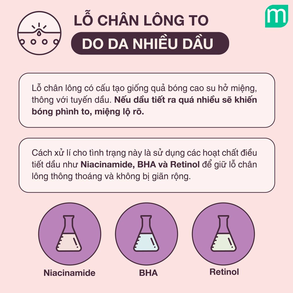 Xử lí lỗ chân lông to cho từng vấn đề da