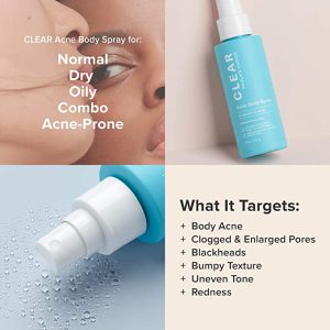 Xịt ngừa mụn Paula's Choice Clear Acne Body 118ml Xịt ngừa mụn Paula's Choice Clear Acne Body 118ml
